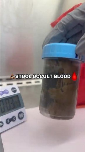 HOW TO: STOOL OCCULT BLOOD! 🩸💩 #mls #laboratorylife #stool #blood
