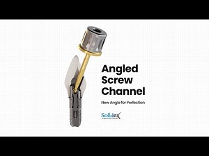 Solidex Angled Screw Channel!