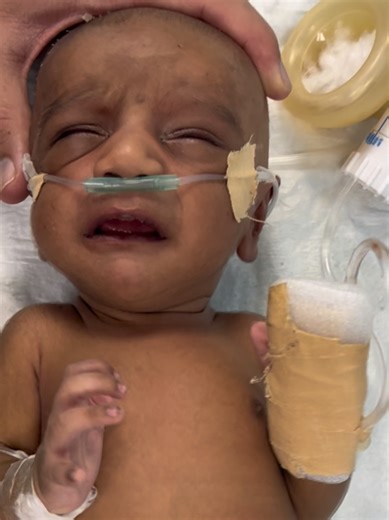 Caring for a Non-Responsive Newborn: What to Know