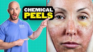 Chemical Peel Demonstration Treating Sun Damage