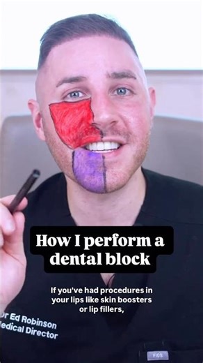 How I perform a dental block for non-surgical aesthetics 💉💋