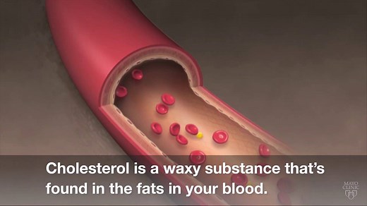 Most people know that high cholesterol is bad for their heart, but few people really understand what cholesterol is. Dr. Claire Haga, a Mayo Clinic family physician, explains why it's so closely related to heart problems. She also discusses the power you have to control it. https://mayocl.in/2GVfhxR | Mayo Clinic