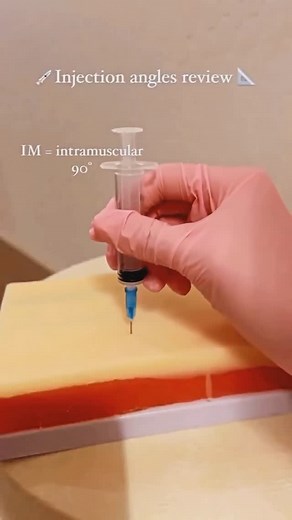 DR HONEY CHOUDHARY 🪬 on Instagram: "IM injections enable quick absorption.🔥 Intramuscular (IM) injections can be administered using several techniques based on the injection site and patient factors. ### 1. **Z-Track Method** - This technique involves displacing the skin and subcutaneous tissue to the side before injecting. After injecting, the skin is released, preventing medication from leaking back out. It’s often used for irritating medications. ### 2. **Standard IM Technique** - The needl