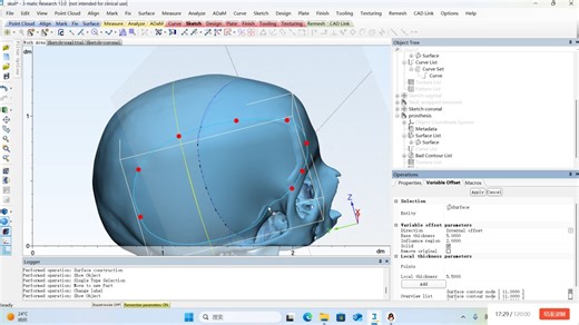 3 matic 修复头盖骨缺损教程