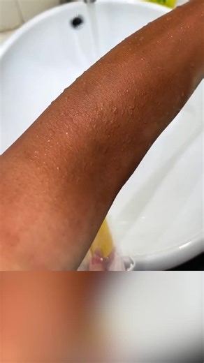 #kojicacid #koji #fyp #foryou #ethiopian_tik_tok