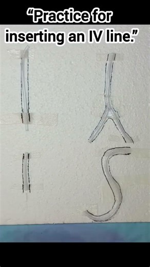 Cannulation practice as per veins type #nurse #viral #doctor #hospital #veins #short #shortvideo