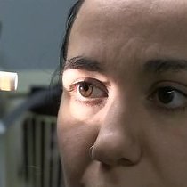 Video: Anatomy and Physiology of Eye; Acuity and Vision Testing