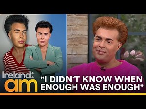 Alan McGarry reflects on cosmetic surgery & taking part in Botched Presents: Plastic Surgery Rewind