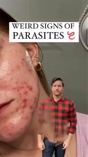 244K views · 1K reactions | RECAP DOWN BELOW!  Acne of Any Kind: ...