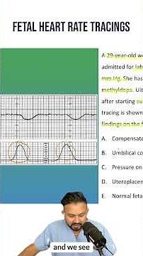 Fetal Heart Tracings for the USMLE (mnemonic!) | HyGuru