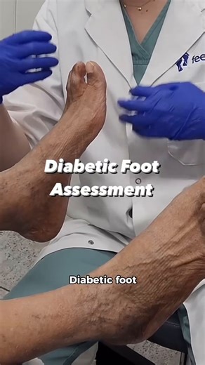 Here’s what happens at a diabetic foot assessment 🦶 If you have diabetes, regular foot checks are so important. At your appointment, we assess circulation, nerve function, skin health, and look for any signs of pressure or risk areas. It’s all about catching small issues before they become big problems. Prevention is key — and your feet will thank you! This content is shared for entertainment purposes only. It is not medical advice and should not be used to diagnose or treat any condition. Plea
