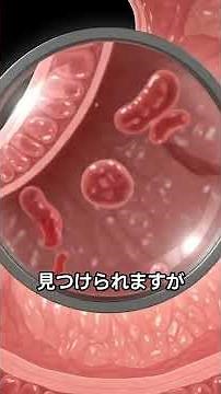 【医師解説】胃バリウム検査で「慢性胃炎・要観察」と言われた方が今すぐすべきこと！