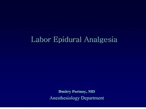 labor epidural analgesia - SlideServe