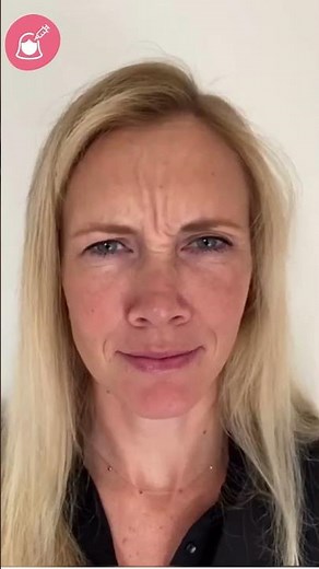 Botox before and after