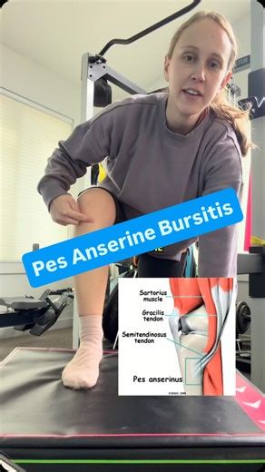 Lisa Mitro, Physical Therapist for Runners on Instagram: "The Pes anserine is a location on the knee just below and to the inside of the kneecap. 3 tendons connect into this area and when they become inflamed, it can cause Pes anserine bursitis: 1. Semitendinosis: hamstring muscle 2. Sartorius 3. Gracilis For rehab, I recommend modifying your activity first so the pain stays low level to no pain and adding in rehab exercises that address these 3 muscles as well as other areas that may be weaker 
