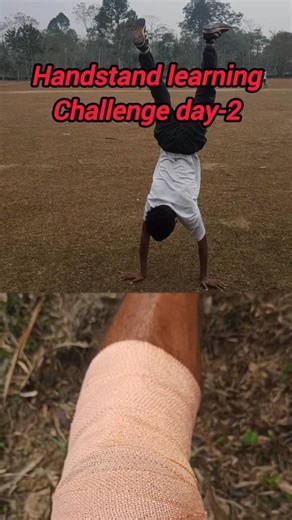 Day-2 Handstand Gone Wrong! 🤕 चोट लग गई? #shorts #handstand #challenge #day2 #injury #hardwork