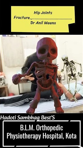Hip joint fracture exercises | Hip Joints Fracture recovery time | hip fracture | #hipfracture