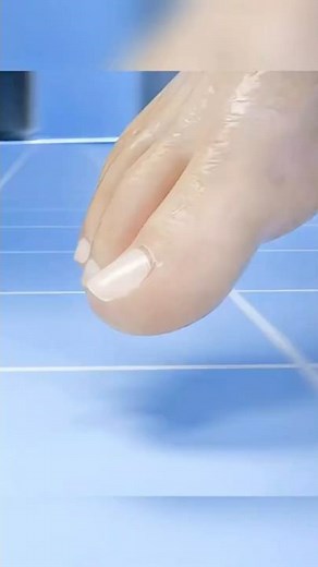 🦶 Toe Hit? 😱 This Trick Could Relieve Your Pain Instantly! ⏱️💡