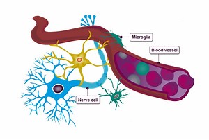 Everything you need to know about the causes of Alzheimer’s disease - Alzheimer's Research UK