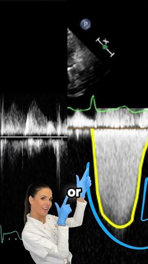 A Pro Tip for Measuring TR Jet Accuracy