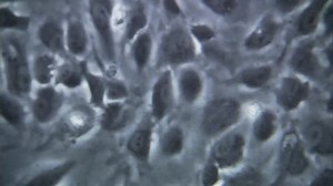 Ebola Virus Moving Under Microscope Stock Footage Video (100% Royalty-free) 7742290 | Shutterstock