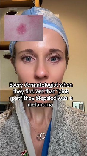Did you know melanoma can be pink? 😮#melanoma #dermatologist