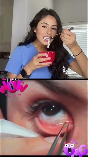 Eye Worms? Let's Find Out!