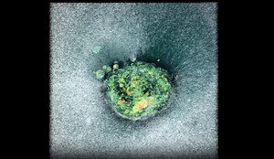 See the First 3D Images of a Human Embryo Implanting, Shedding Light on the Crucial but Little-Known Process