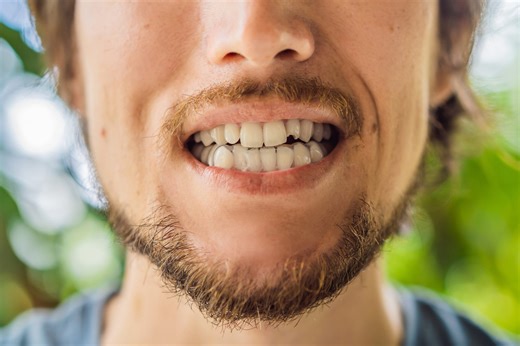 New drug that stimulates natural tooth regrowth is entering human trials