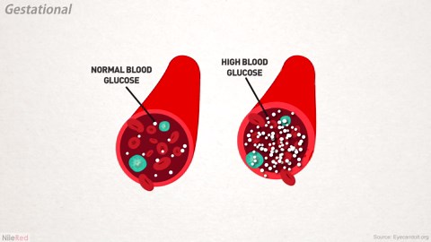 Recreating a 19th-Century Diabetes Test at Home (Safely!)
