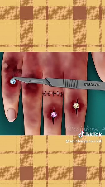 ASMR Animation: A Relaxing Treatment Experience