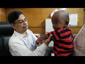 Pulled elbow, closed reduction Adamya Hospital videos