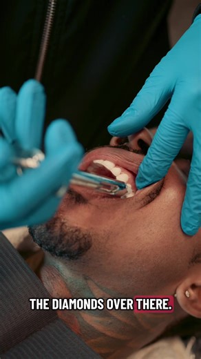 Diamonds, Gold, and Veneers! What do you all think about his setup | veneer technician