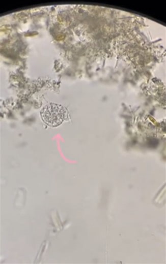 Farewell, fren! A tiny microscopic moment that hits hard