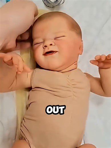 Rare Birth: Baby Born Completely Covered in Uniqueness