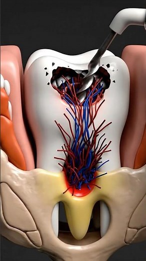 “Tooth Decay in 3D: How Far It Can Go (Shocking)” #3danimation #science #viral