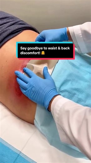 Natural herbal back patch, relieve lumbar pain & relax tight muscles. Warm & comfortable, great for daily care. Say goodbye to back discomfort! #lumbarpatch #backpainrelief #wellness #selfcare #fyp wzy