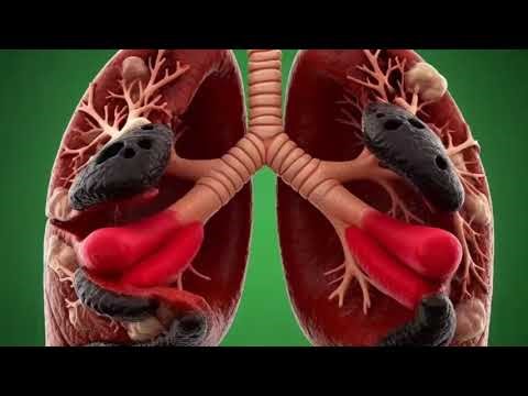 “The Hidden Dangers of Smoking – Animated Human Anatomy”