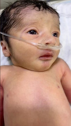 From Crisis to Care: Witness a Newborn’s Emergency NICU Transfer| blue baby syndrome #nicumiracle