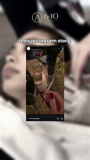 “My Botox isn’t lasting…” #Botox #fyp #trend #funny #relatablememes