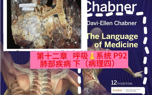 医学牲报道～chapter12:pulmonary disorders P92
