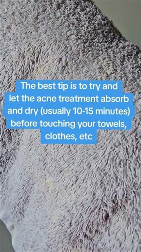 Why your towels might be getting bleach spots