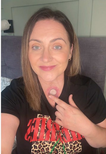 Thank You and Raising Throat Cancer Awareness