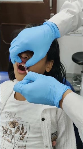 milk Tooth extraction
