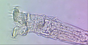 Philodina - Rotifers