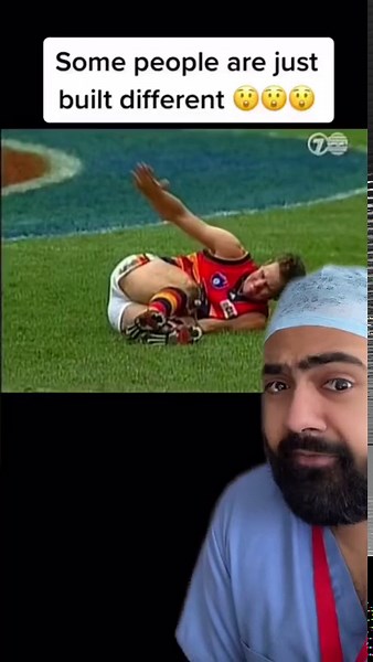Doctor reacts to viral clip of athlete’s leg disaster