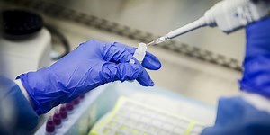 University of Arizona awarded $7.3 million grant to study long COVID-19 impact