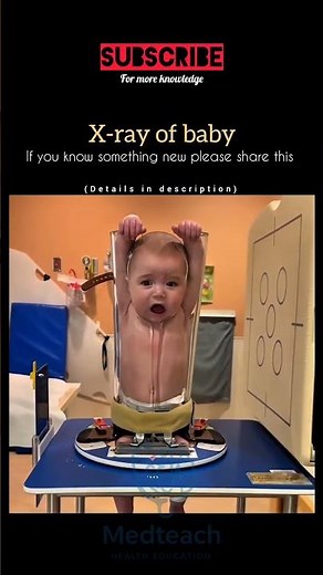 Baby Whole Body X-Ray Explained | Safe or Risky? #youtubeshorts #medicalshorts