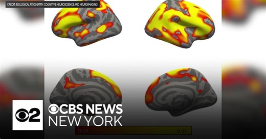 Study of 9/11 first responders' brains helps researchers understand PTSD