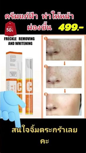 ครีมลดฝ้า Eelhoe Freckle Removal Cream ลดทันที 50% เหลือเพียง 499 บาท